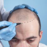 Front Line Hair Fixing Guide