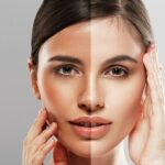 Is Permanent Skin Whitening Painful?