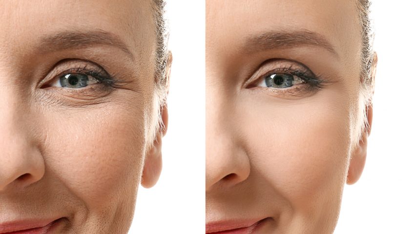 Top 10 benefits of Glutathione for skin and health
