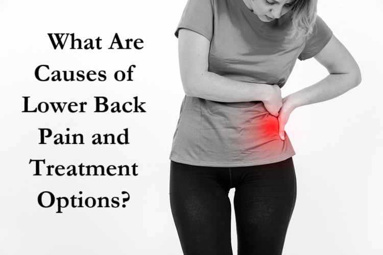What Are Causes of Lower Back Pain and Treatment Options?